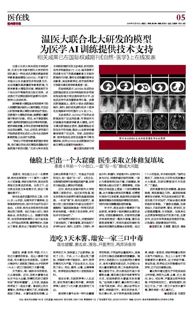 2024121805 温州都市报.jpg